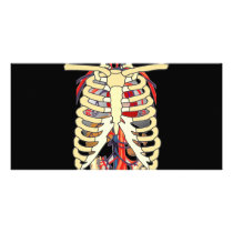 Ribs Veins Enlarged Heart Customized Photo Card