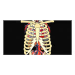 Ribs Veins Enlarged Heart Customized Photo Card