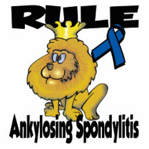 Rule Ankylosing Spondylitis Photo Sculpture