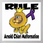 Rule Arnold Chiari Malformation Poster