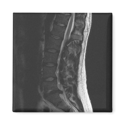 Ruptured Disc Magnet by rderstadt