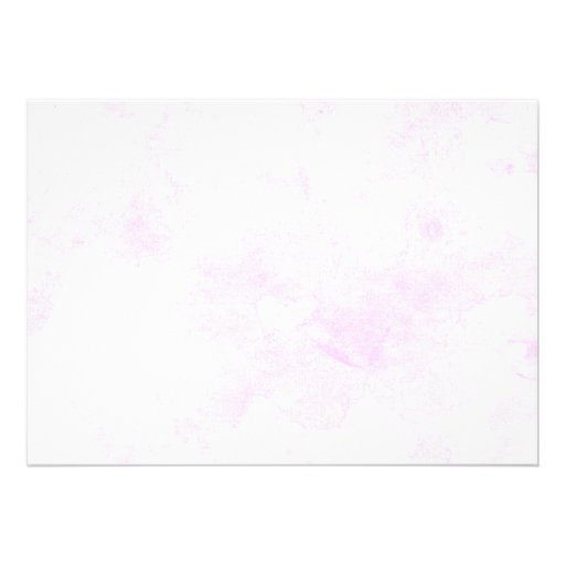 Rustic Palm Tree Beach Bridal Shower Invitations