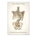 Scoliosis Spine posters