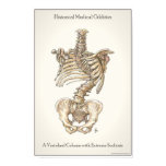 Scoliosis Spine Print