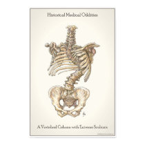 Scoliosis Spine posters