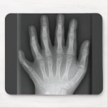 Seis manos digitadas, rareza médica, radiografía tapetes para ratón