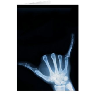 Shaka Sign X-Ray (Hang Loose) card
