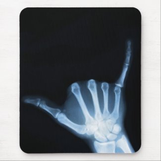 Shaka Sign X-Ray (Hang Loose) mousepad