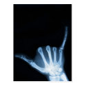 Shaka Sign X-Ray (Hang Loose) Post Cards