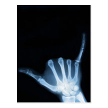 Shaka Sign X-Ray (Hang Loose) Post Cards