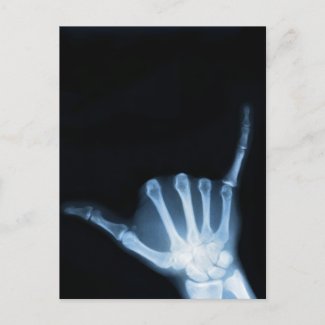 Shaka Sign X-Ray (Hang Loose) postcard