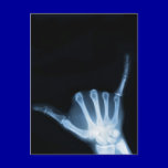 Shaka Sign X-Ray (Hang Loose) postcards