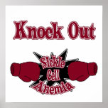Sickle Cell Anemia Print