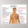 Side Effects Chart for the Drug Alprazolam Posters