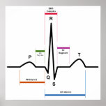 Labeled Ekg Diagram