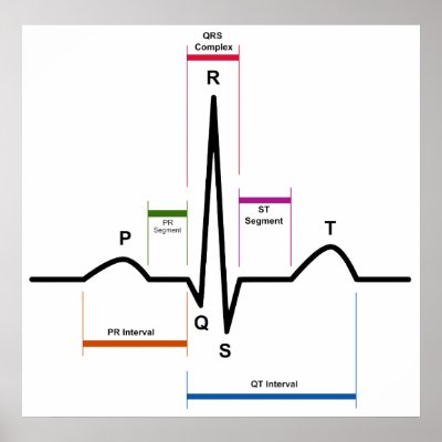 Labeled Ekg Diagram