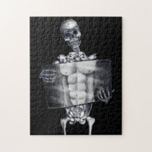 Skeleton Chest Xray Puzzle