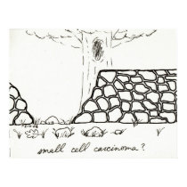 Small Cell Carcinoma print by bio_muse Small Cell Carcinoma print