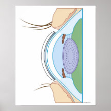 Soft Contact Lens Posters