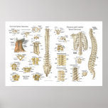 Spinal and Vertebrae Anatomy Poster 24" X 36"
