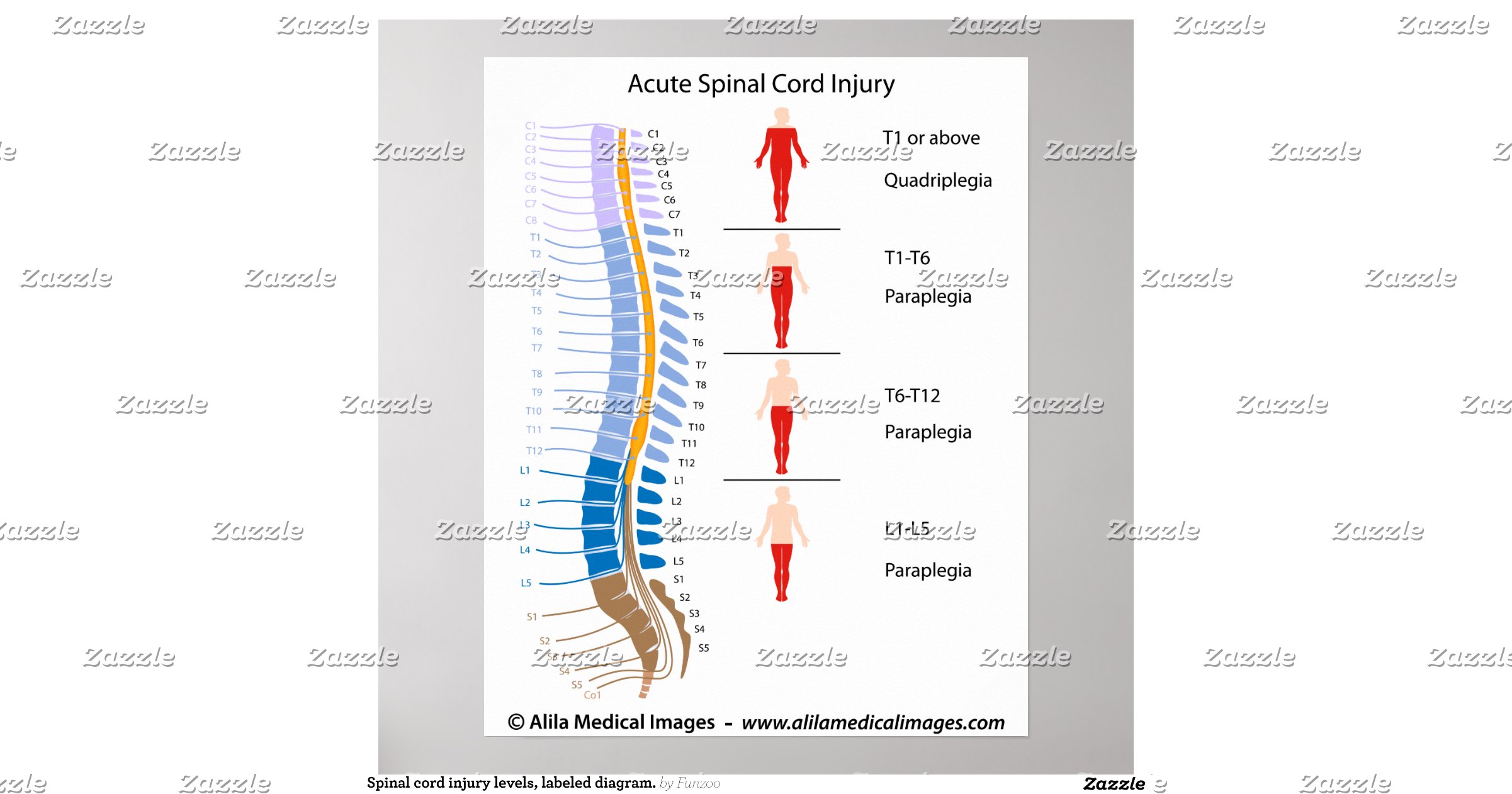 spinal_cord_injury_levels_labeled_diagram_poster