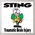 STING Traumatic Brain Injury posters