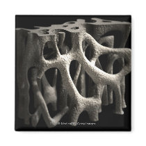 Structure of a bone with osteoporosis magnets