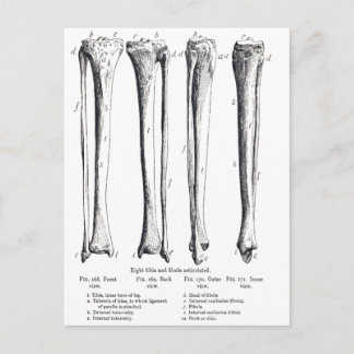 Bone Diagram Gifts on Zazzle