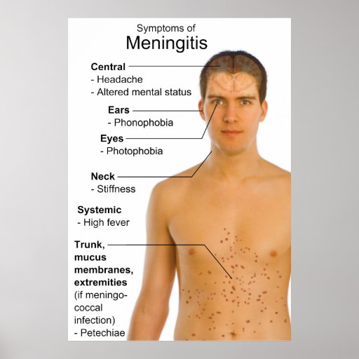 Symptoms Chart Of Inflammation Disease Meningitis Poster | Zazzle