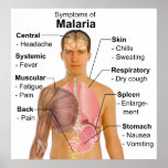 Symptoms Chart of Mosquito-Borne Malaria Disease posters