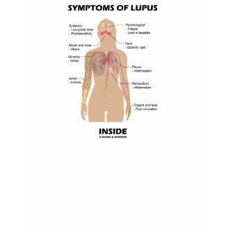 Symptoms Of Lupus Inside (Autoimmune Disorder) shirt