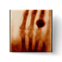 The First X-Ray, 1901, Photograph buttons by harlowandcompany The First X-Ray, 1901, Photograph buttons