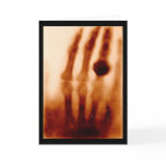 The First X-Ray, 1901, Photograph Greeting Cards