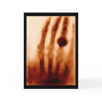 The First X-Ray, 1901, Photograph Greeting Cards