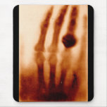 The First X-Ray, 1901, Photograph Mouse Mats