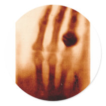 The First X-Ray, 1901, Photograph stickers by harlowandcompany The First X-Ray, 1901, Photograph stickers