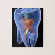 Tooth, transparent cross section of a molar puzzles