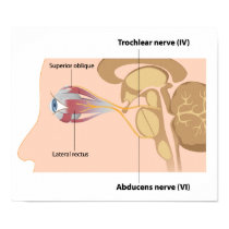 Trochlear and Abducens nerves Poster