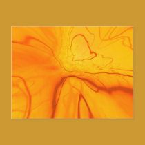 Vascular Disease postcards