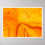 Vascular Disease Print