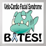 Velo-Cardio Facial Syndrome BITES Print
