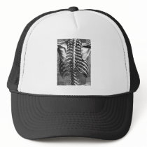 Vintage drawing of a spine and ribcage trucker hat