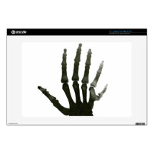 Vintage X-ray Six-fingered Hand Skeleton Decals For 13" Laptops