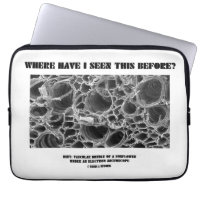Where Have I Seen This Before? Vascular Bundle Computer Sleeves
