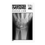 wrist x-ray postage