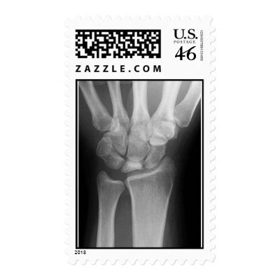 wrist x-ray stamp by jeffsdx