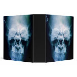 X-Head binders