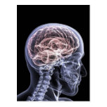 X-Ray Brain Postcard