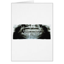 X-Ray cards by CrazyGear X-Ray cards