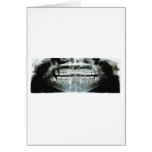 X-Ray cards